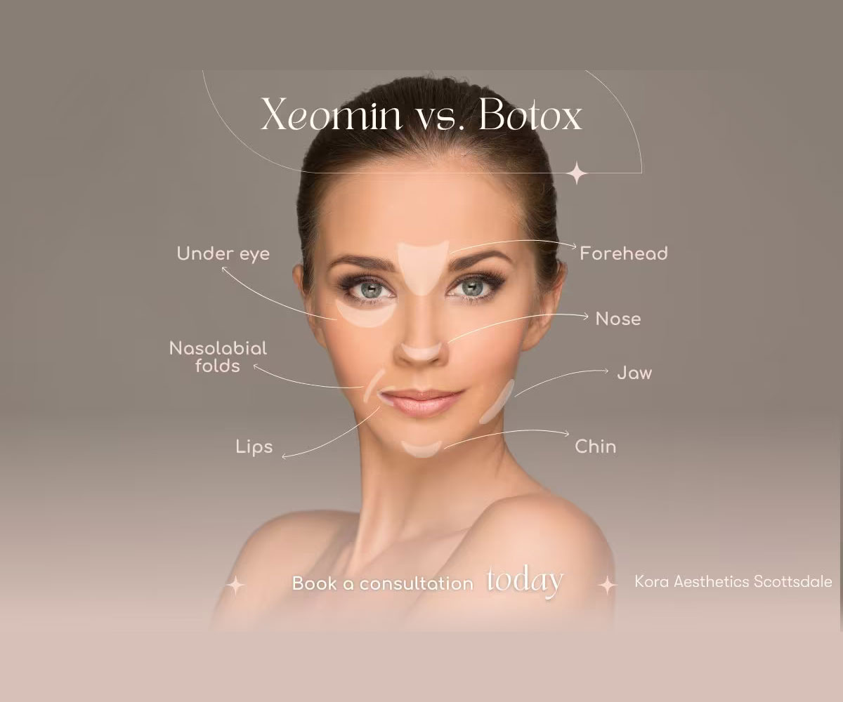 Botox-vs.-Dysport-vs.-Xeomin