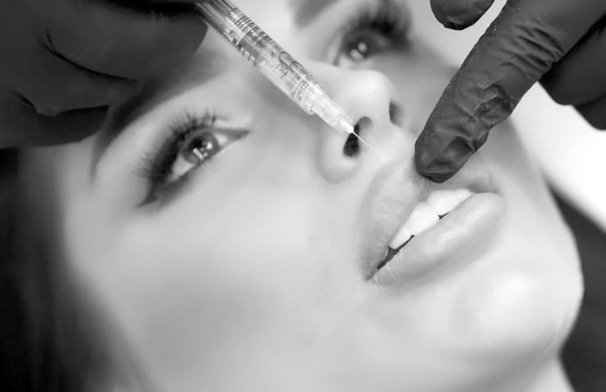 Unfiltered-Aesthetics-Lip-Filler